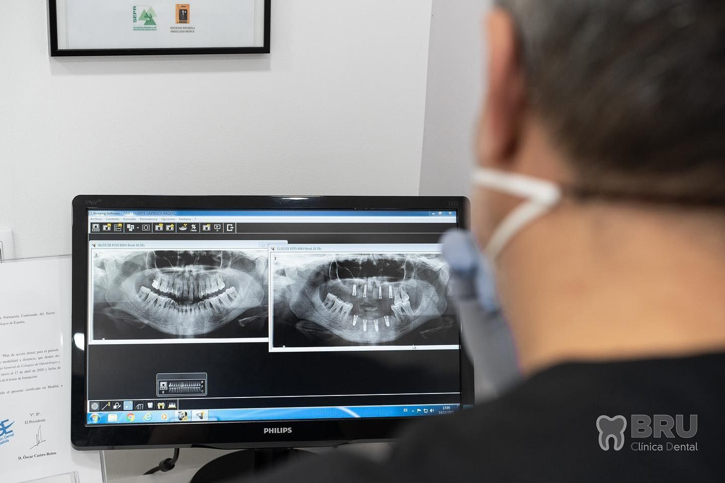 Estudio de radiografías en Bru