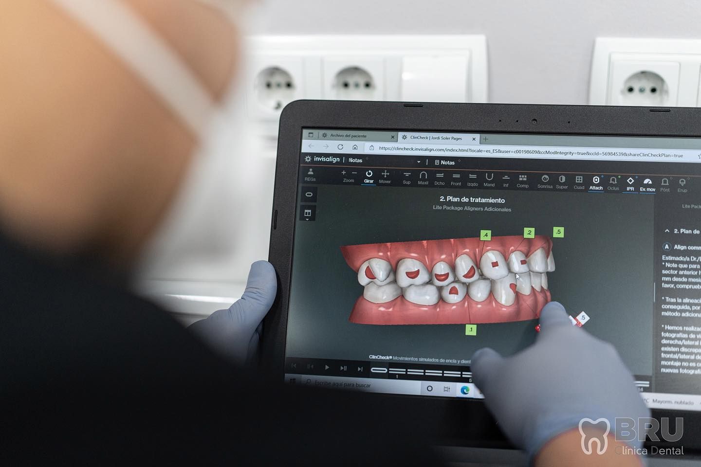 Planificación digital de ortodoncia en Bru